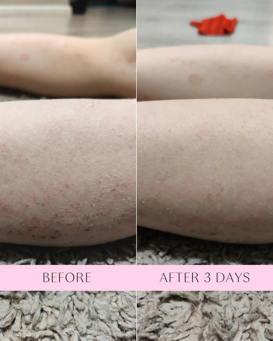 Crème de sauvetage à la propolis et aux probiotiques - Flow Cosmetics