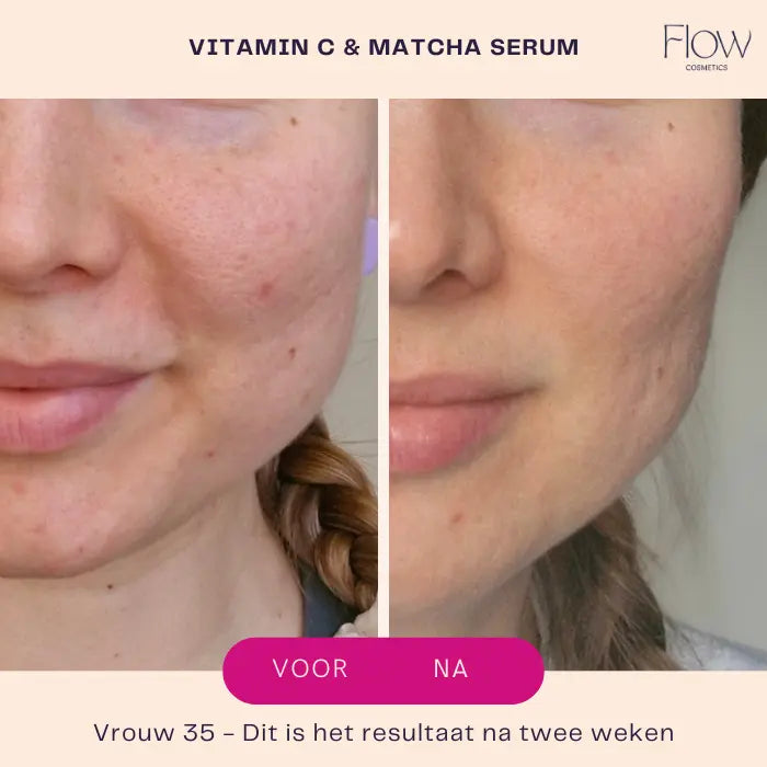 Flow Cosmetics Vitamin C Matcha Serum close-up voor en na met antioxidanten boost