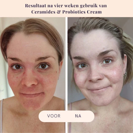Crèmes cosmétiques fluides aux céramides et aux probiotiques