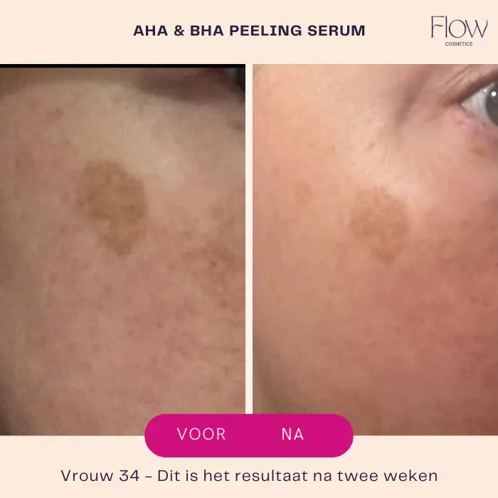 AHA & BHA Peeling Serum-Flow Cosmetics