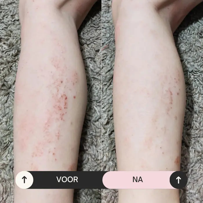 Propolis & Probiotics Rescue Cream-Flow Cosmetics