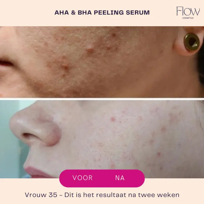 AHA &amp; BHA Peeling Serum-Flow Cosmetics