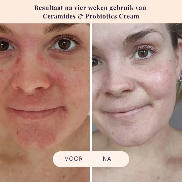 Voor en na behandeling