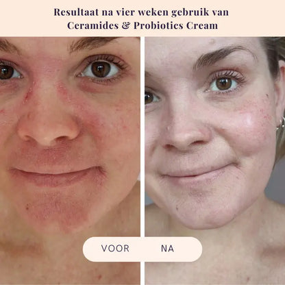 Voor en na behandeling