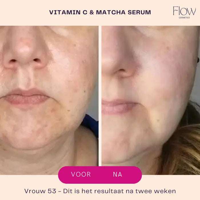 Flow Cosmetics Vitamin C Matcha Serum close-up met antioxidanten boost voor en na.