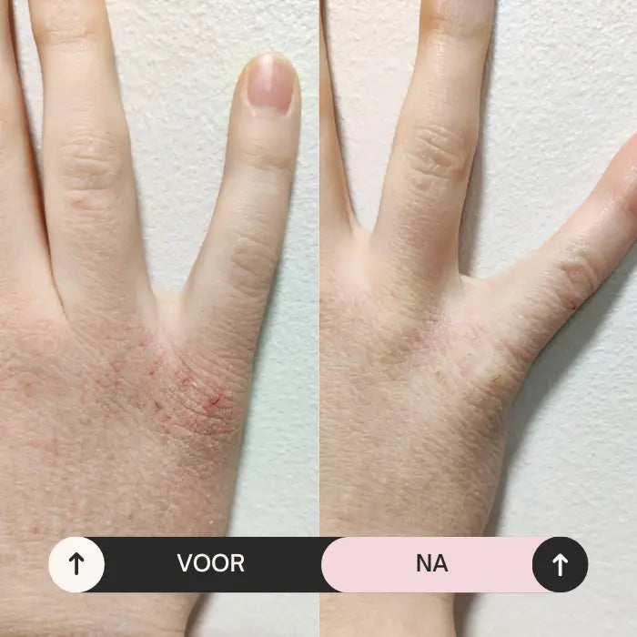 Handen voor en na