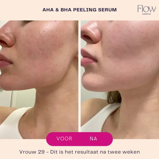 AHA BHA peel serum before and after: more even skin and a glowing result
