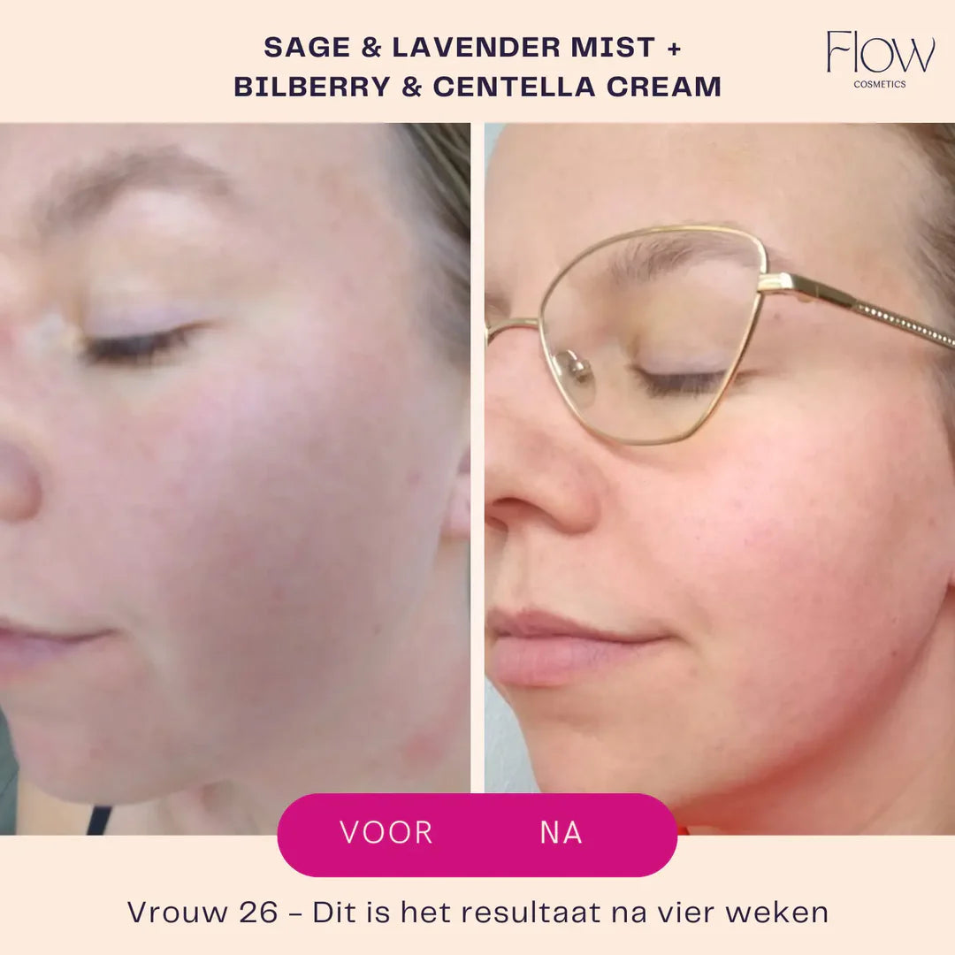Voor na resultaat acne huid natuurlijke gezichtsmist vermindert roodheid onzuiverheden huidverbetering