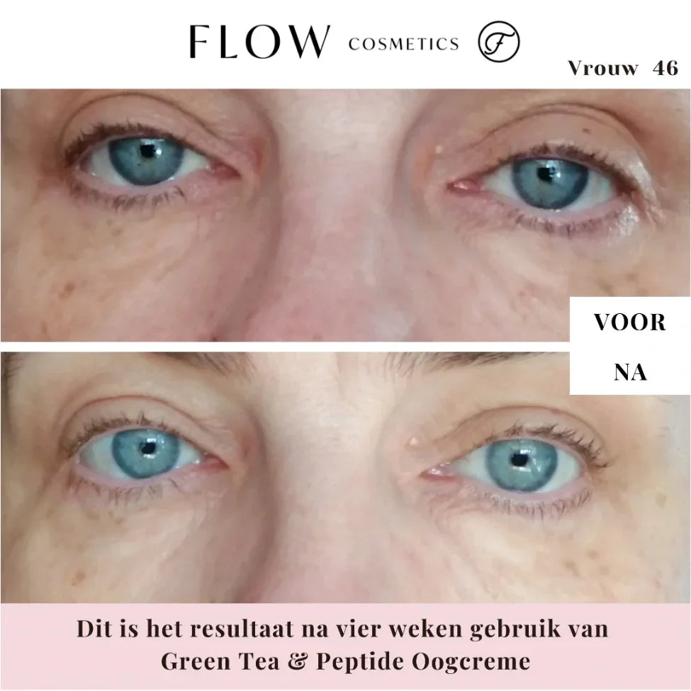 Resultaat na vier weken gebruik van Flow oogcrème vermindert fijne lijntjes en donkere kringen zichtbaar