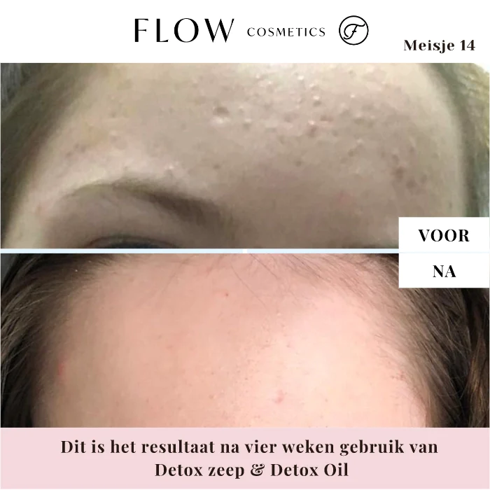 Deze zeep maakt je huid niet droog omdat het biologische sheaboter, biologische jojoba olie en biologische sesamolie bevat.
